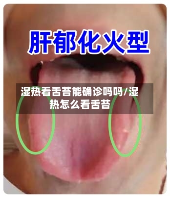 湿热看舌苔能确诊吗吗/湿热怎么看舌苔-第2张图片