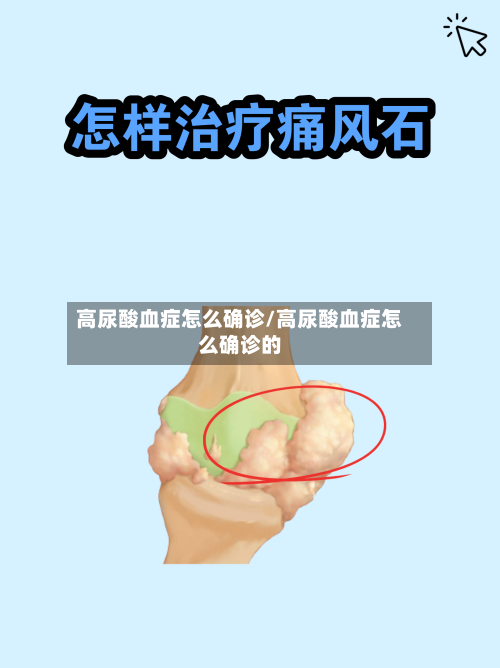 高尿酸血症怎么确诊/高尿酸血症怎么确诊的